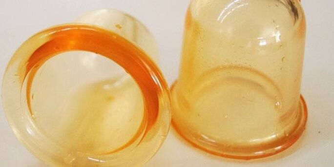 prostatit tedavisi için bardaklar