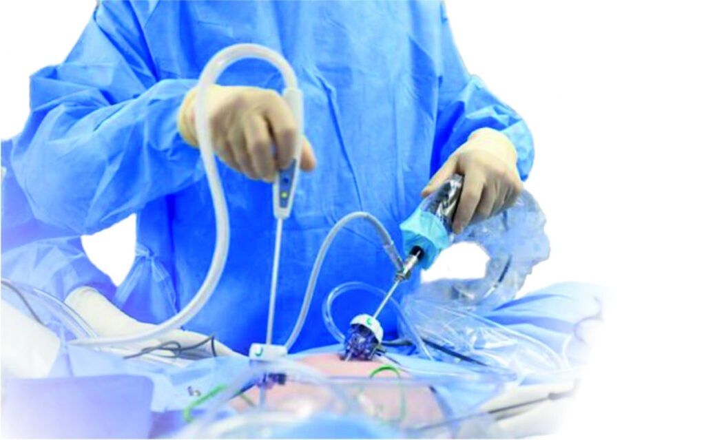 operasyon